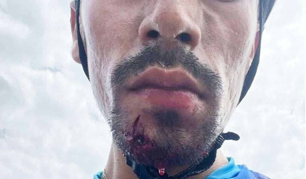 Iván Ramiro Sosa se recupera en centro hospitalario tras ser agredido por un conductor